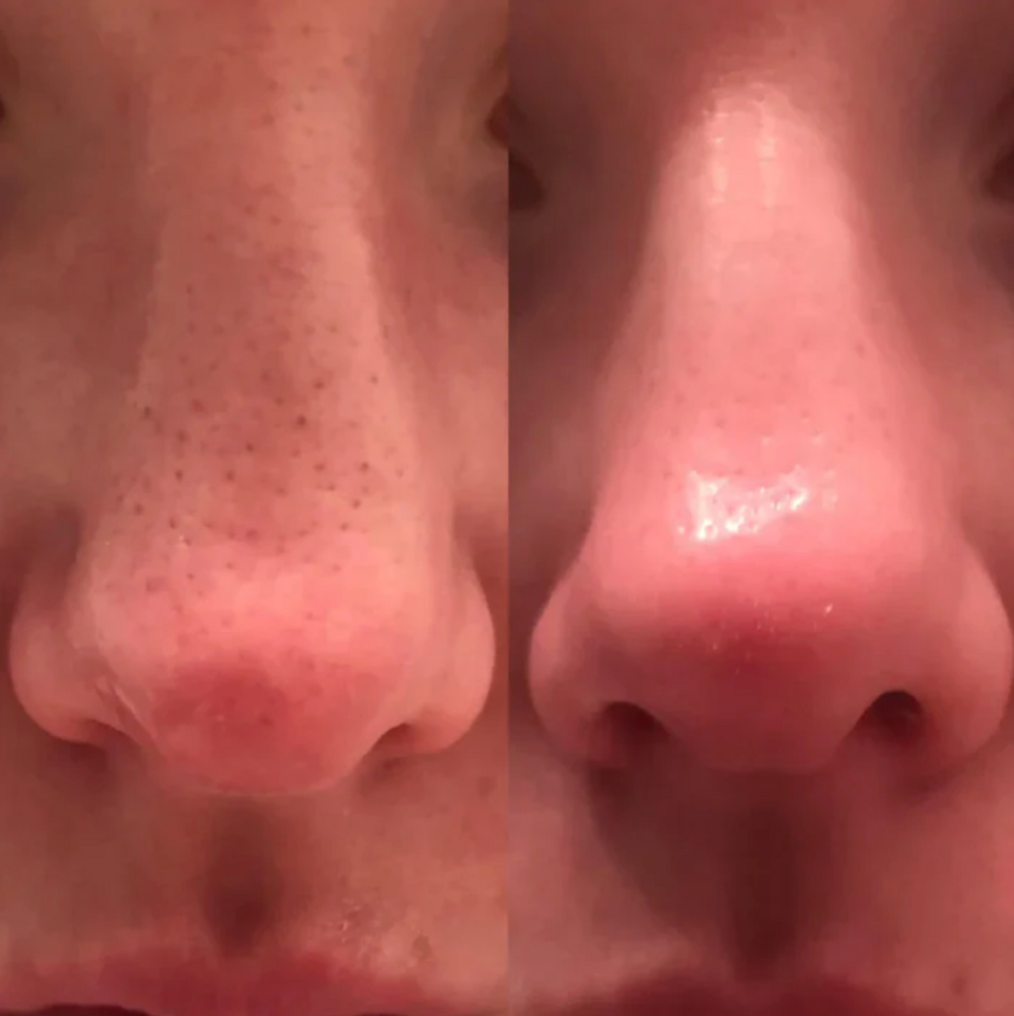 DR.MELAXIN PEEL SHOT