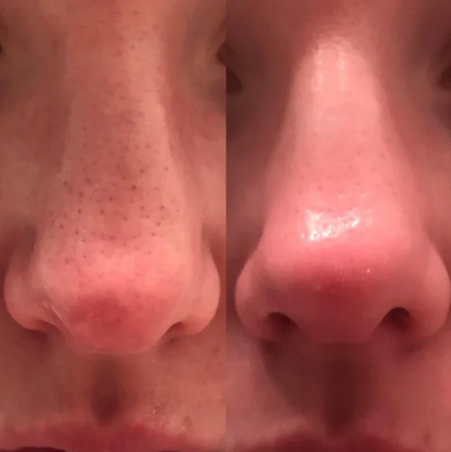 DR.MELAXIN PEEL SHOT