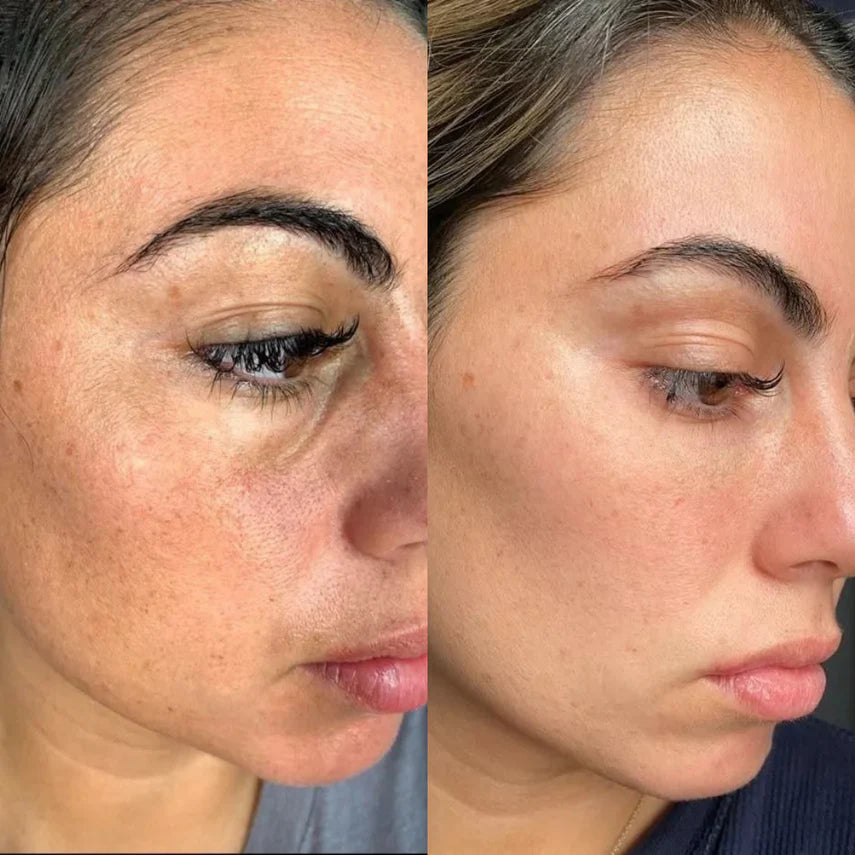 DR.MELAXIN PEEL SHOT